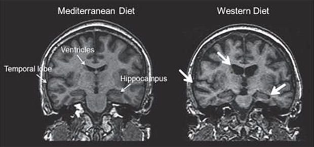 11 supercibi che aiutano il cervello