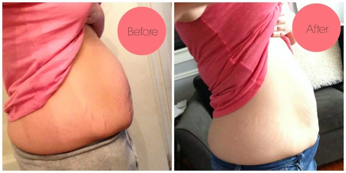 Diete drastiche, qual è la migliore?