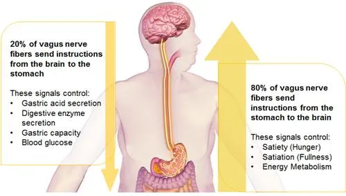 Contro l’obesità arriva il pacemaker dell’appetito