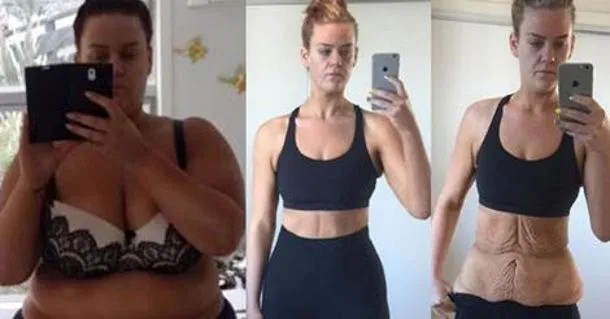 Foto prima e dopo la dieta, ecco cosa nascondono
