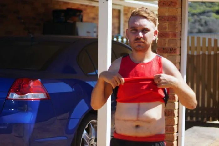 Assume estratto di tè verde e Garcinia, ecco cosa gli accade