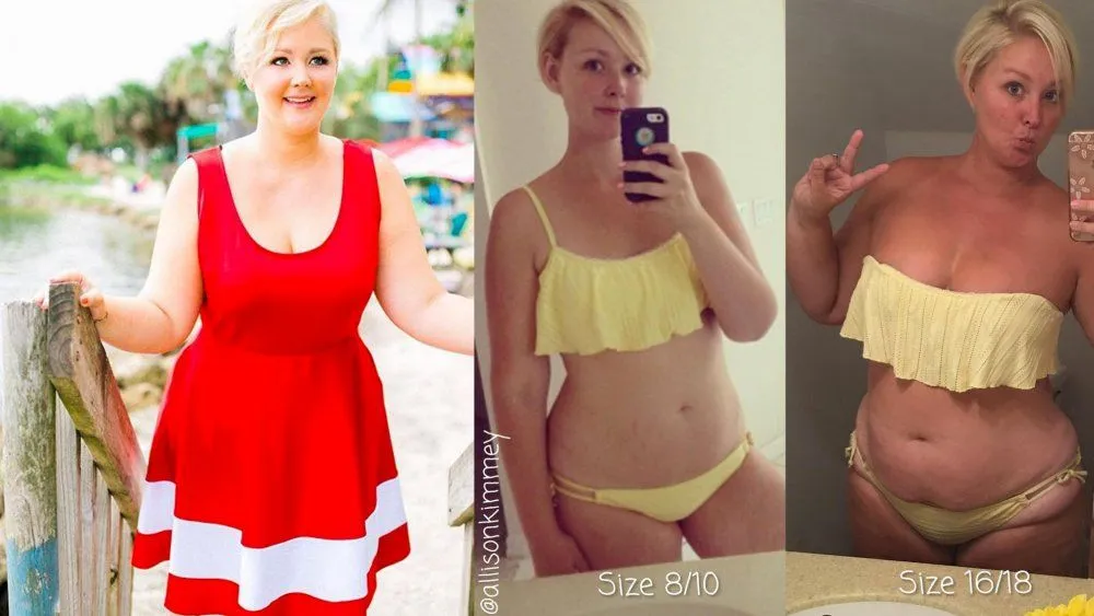 Le foto prima e dopo di questa donna fanno scalpore