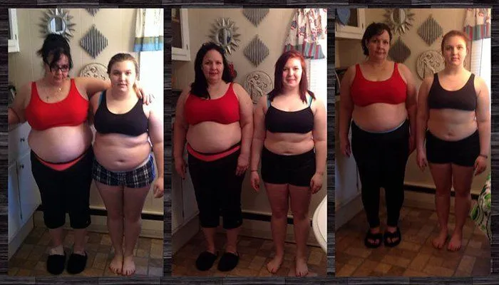 Dimagrimento estremo: la storia virale di madre e figlia