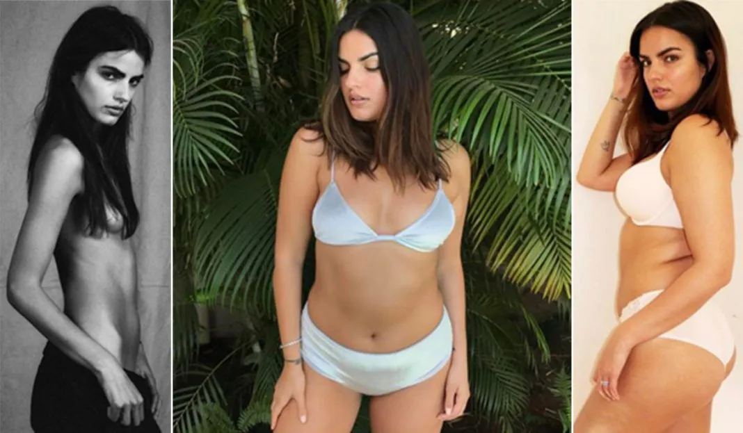 Liza Golden-Bhojwan, la modella che mangiava 500 calorie al giorno