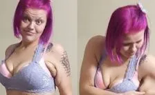 qual e la differenza tra chirurgia bariatrica e rimozione della pelle