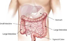 disbiosi intestinale dieta e cura