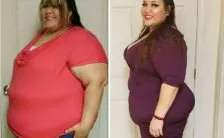 ipnodieta la chirurgia gastrica virtuale