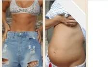 colon irritabile una modella lo combatte con la dieta