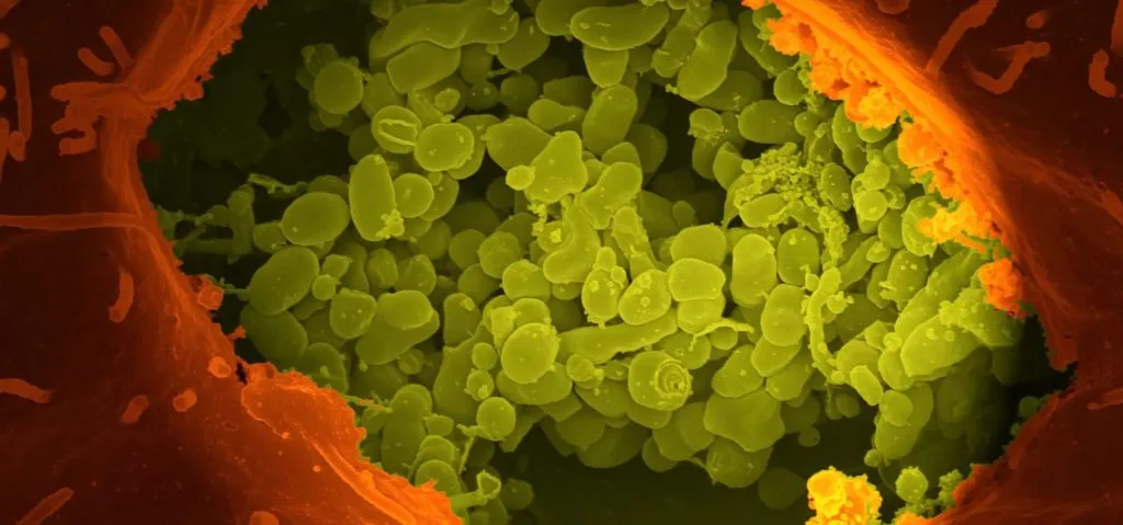 intestino intestino